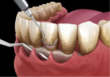 Periodontia